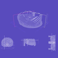 Computer-Assisted Precise Hepatectomys